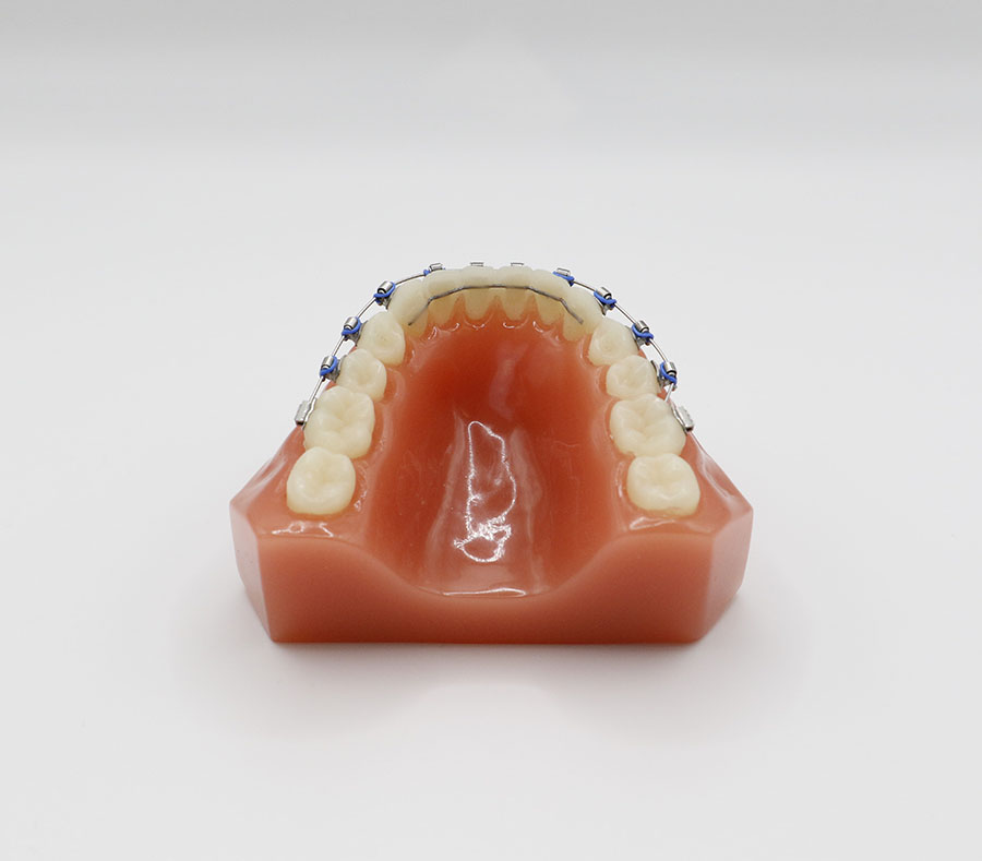 Permanent Fixed Wires