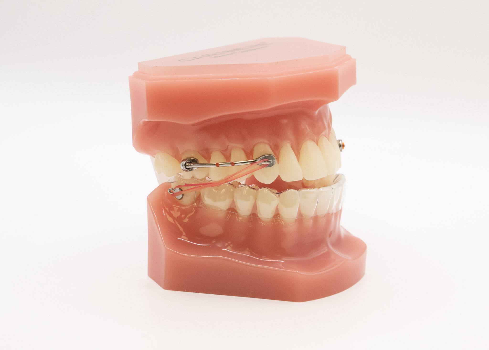 Carriere Motion Appliance